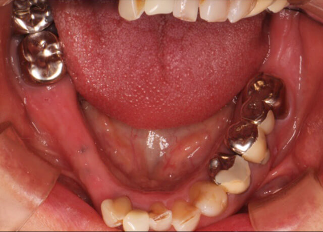 Before image