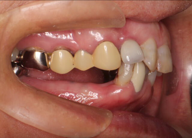 Before image