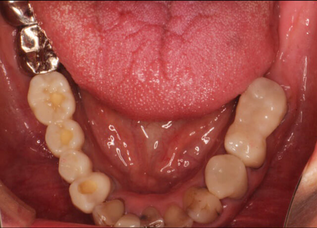 After image