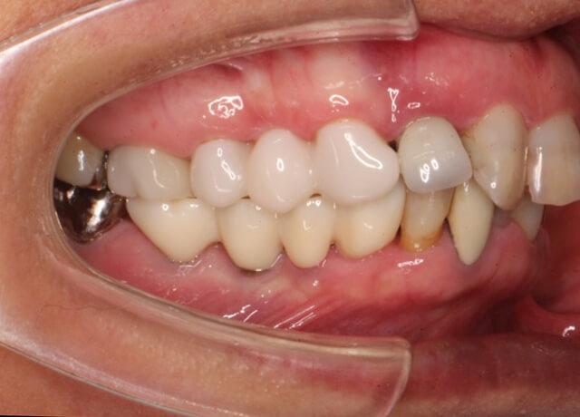 After image